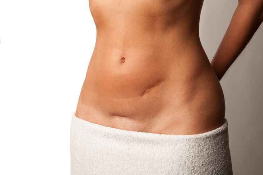 scars-shutterstock_144182995